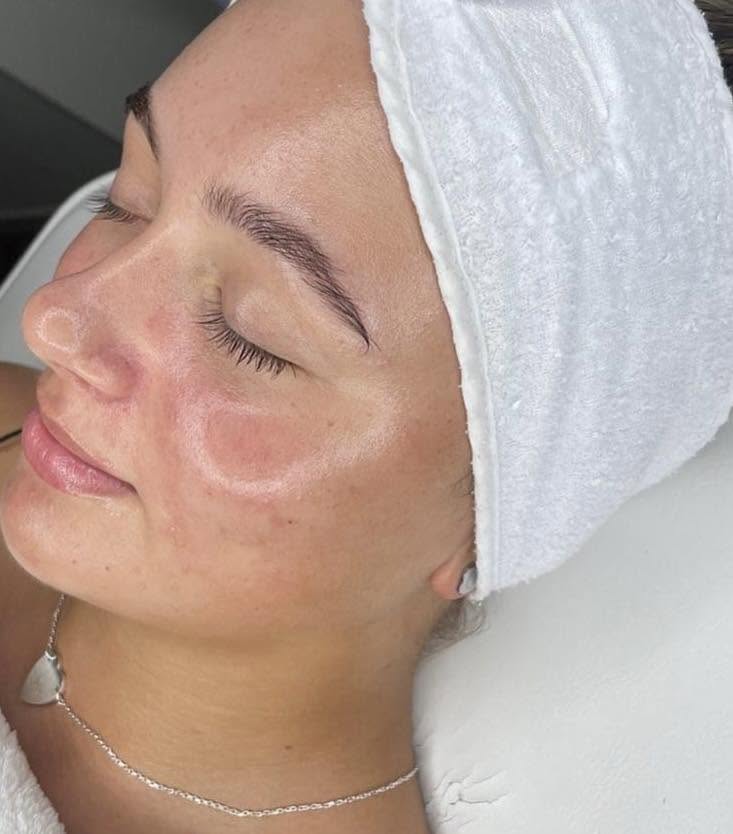 Client with post-facial radiance at Rollo House Longniddry